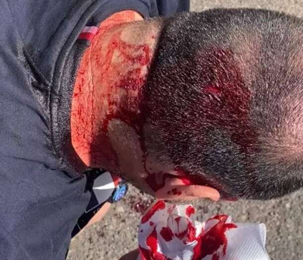 Golpe recibido por el agente de la Policía Nacional/C7.